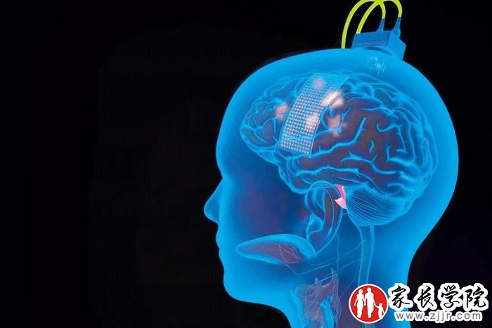 安的大脑表面植入了一个薄薄的矩形电极,以接收其试图说话时发出的信号。图/加州大学